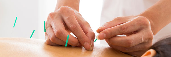 鍼灸治療